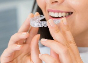 invisalign
