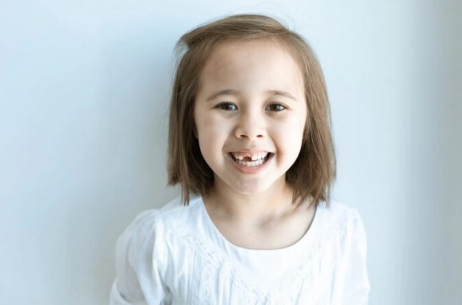 missing teeth
